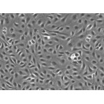 Human Pulmonary Artery Endothelial Cells (HPAEC)